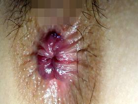 美女のひくつく肛門 放屁　サンプル画像05